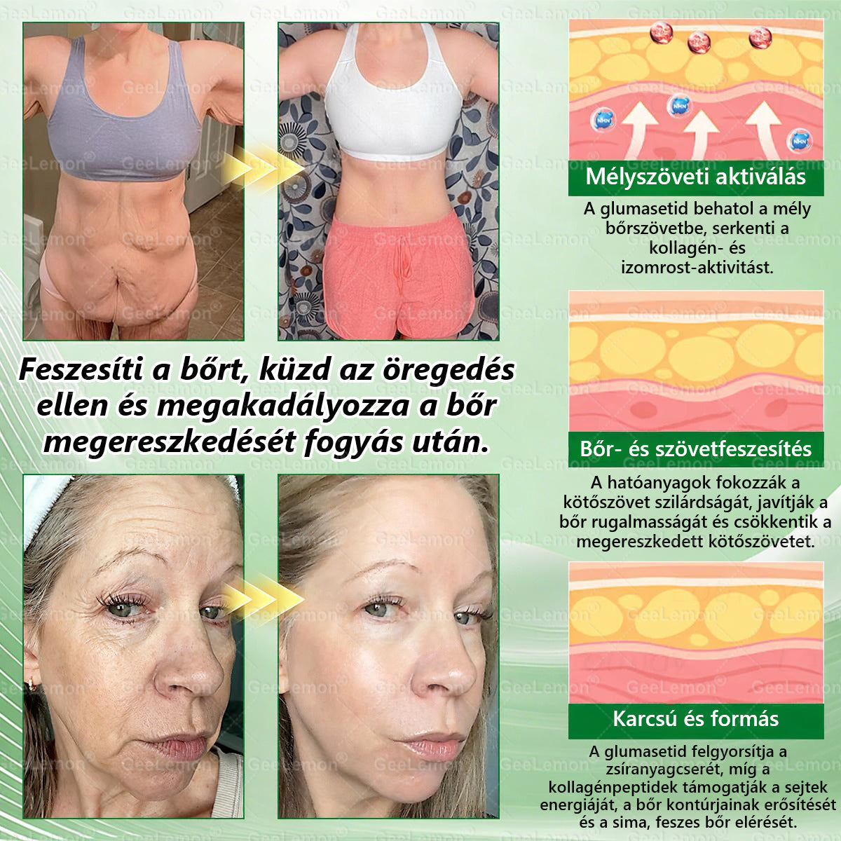 🌿Ajánlott a Semmelweis Kórház által · 👩‍⚕️BENU hivatalos üzlet| 🎁 𝐆𝐞𝑒𝐿𝑒𝐦𝐨𝐧® Glumasetide 8 az 1-ben Karcsú és Egészséges Nano Mikrotűs Tapasz 🇭🇺